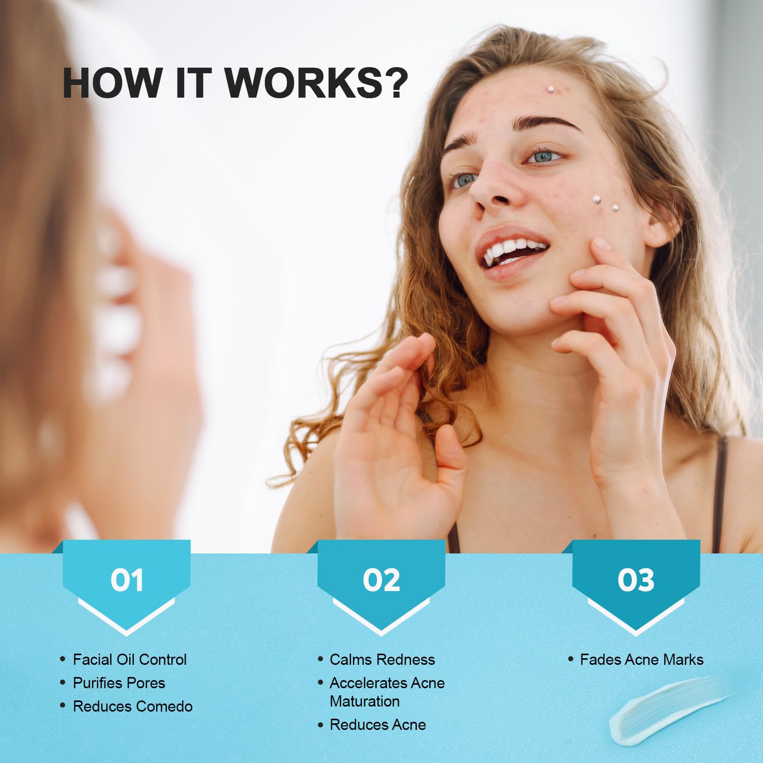 Creme para Acne - (Resultados em apenas 7 dias de uso)